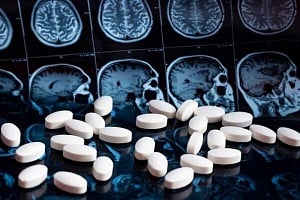 Απογοήτευση στις δοκιμές: τα φάρμακα GLP-1 δεν επιβραδύνουν την Αλτσχάιμερ