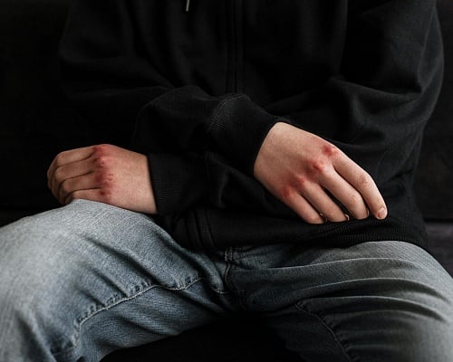 «Πήγα να τον πάρω και δεν τον κατάλαβα»: Μητέρα καταγγέλλει άγριο ξυλοδαρμό του 15χρονου γιου της σε σχολείο «Πήγα να τον πάρω και δεν τον κατάλαβα»: Μητέρα καταγγέλλει άγριο ξυλοδαρμό του 15χρονου γιου της σε σχολείο